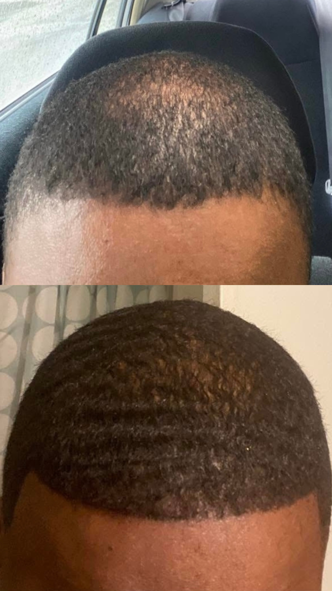 Hair Oil
